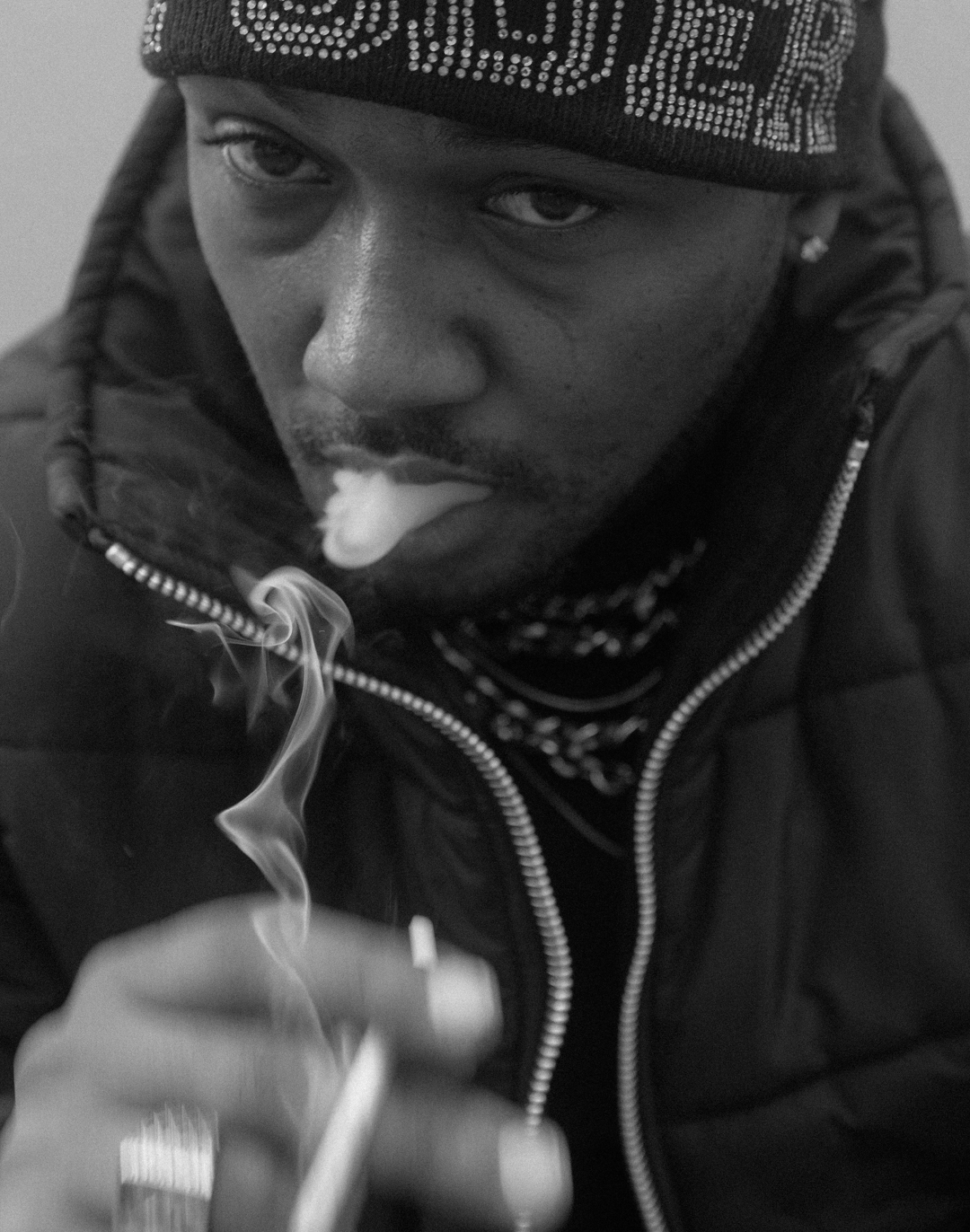 Rarekidd